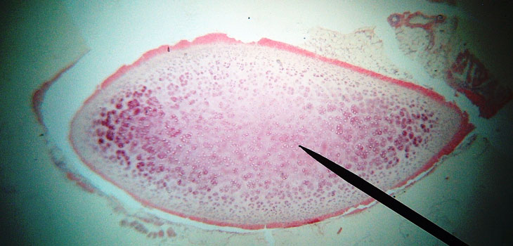 Regenerative_HyalineCartilage 2