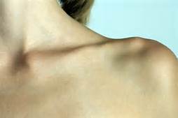 clavicle fx 2