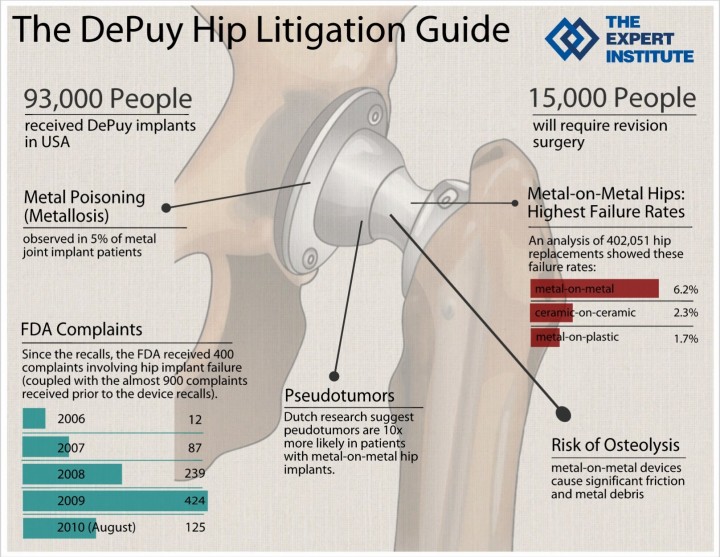 DePuy-Hip-InfoGraphic-2xshu78st9ab4iulp82ha8