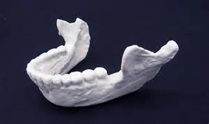 3D jaw