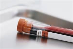 blood test tube 2