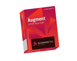 Augment 2