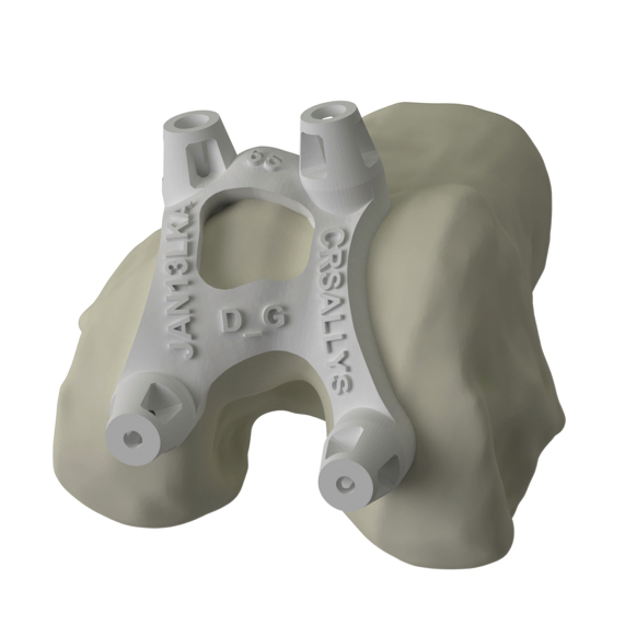 25 3d Printed Knee Replacement Png Abi