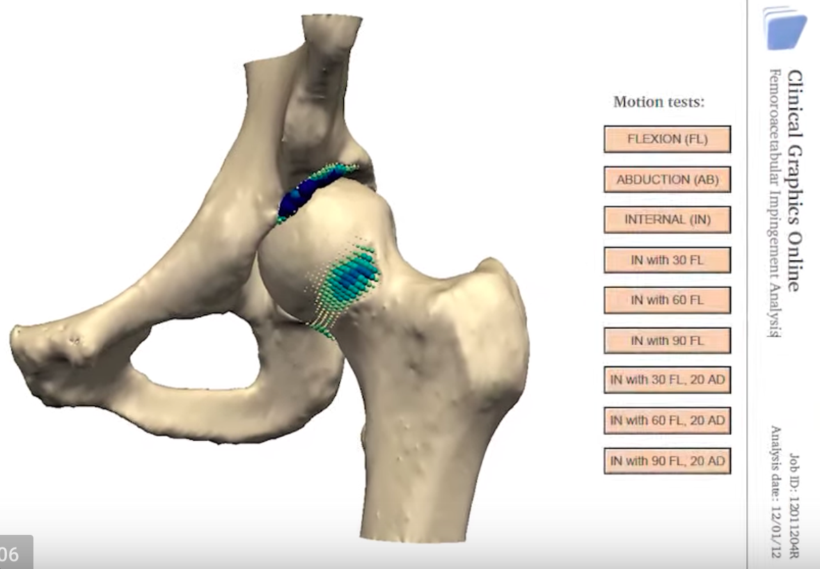 simulation_by_clinical_graphics