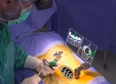 An Israeli startup is showing us the future of spine surgery with ...