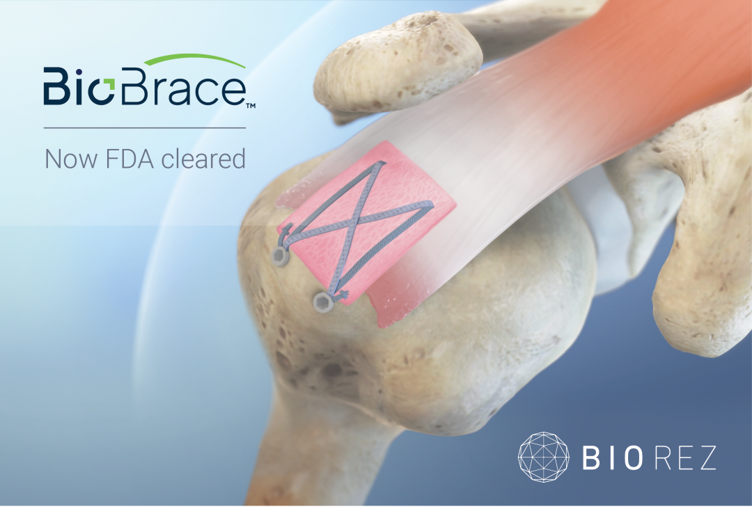 1st biocomposite to repair tendons & ligaments both biologically and ...